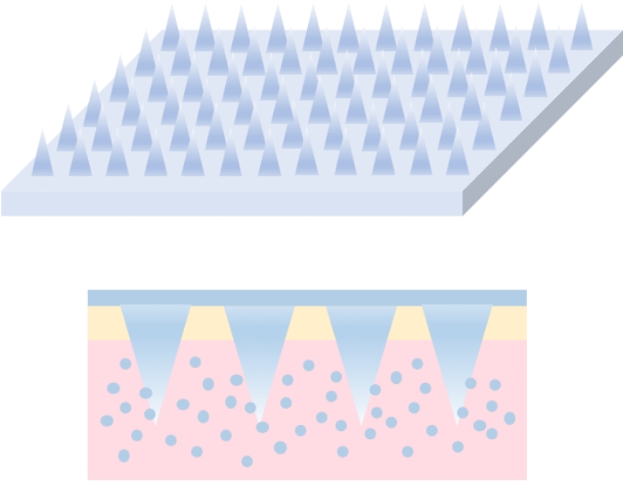 Type１：Active ingredients fabricated into microneedles